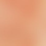 Purpura pigmentosa progressiva. incident light microscopy, blurred, yellow-brownish spots (star),...