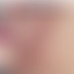 Verrucae planae juveniles. Leicht rötliche, teils auch bräunliche und hautfarbene, dicht und stel...