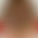 Behaarte Kopfhaut:&nbsp;normaler gleichmäßiger&nbsp;Haarbesatz.
