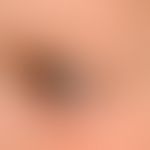skin, normal: eyelid and eye area
