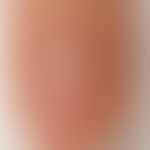 Nail: normally structured nail, normal nail fold
