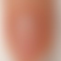Nail: normally structured nail, normal nail fold

