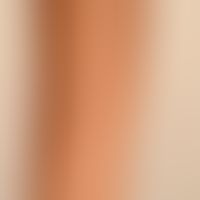 Skin of the forearm: normal actinically undamaged skin of a child.
