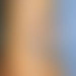 Kaposi sarcoma classic: nodular, soft-elastic tumours on the lower leg that have been present for...