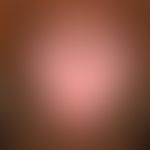 Melkersson-Rosenthal syndrome. distinct doughy swelling of the upper lip. pronounced lingua plica...
