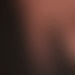 Thrombangiitis obliterans: spotty erythema of the fingers and back of the hand that has been pres...