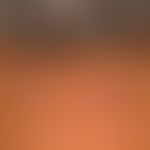 eczema atopic in dark skin): here as partial manifestation of a generalized intrinsic atopic ecze...