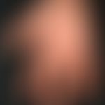 Erythema exsudativum multiforme. 4-day-old, suddenly appearing, itchy, disseminated exanthema wit...