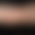 Urticaria pigmentosa des Kindesalters:&nbsp;6 Jahre alter Junge. Seit&nbsp;dem 2. LJ&nbsp;&nbsp;"...