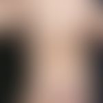 Urticaria pigmentosa des Kindesalters: Disseminierte, 0,2-1,0 cm große, symptomlose, hellbraune F...