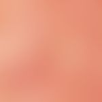Milia. reflected light microscopy: milia in the cheek area. whitish, pearly round foci (marked wi...