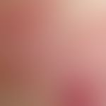 Milia. secondary milia in a blistering primary disease: Multiple, chronically stationary, grouped...