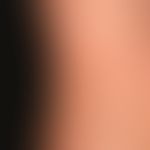Microsphere. 2 weeks of persistent, size progressive, itchy plaques measuring 2.5 x 2.5 cm as wel...