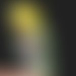 Trichotillomania: Feather-plucking bird Bobby.
