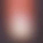 Tinea unguium: distalsubungual discoloration in fungal infection; the nail matrix is crumbled und...