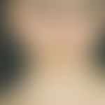 Parry-Romberg-Syndrom:&nbsp;Halbseitige Atrophie von Haut, Fettgewebe und Muskulatur des Gesichts...