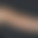 Bandförmige zirkumskripte Sklerodermie: seit Jahren bestehende und progrediente, symptomlose bräu...