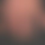 Pincer-nails: systemische Sklerodermie mit kontinuierlicher Bildung von Zangennägel. Diese sind i...