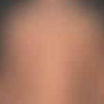 Syphilis (Frühsyphilis):&nbsp;makulöses,&nbsp;chronisches Exanthem. Stellenweise werden auch&nbsp...