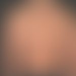 Syphilis: Frühsyphilis; rein makulöses nicht juckendes dichtes Exanthem.
