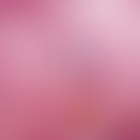 A single painful plantar wart existing for several months. The diagnosis plantar wart can easily ...