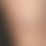Nodule, skin-coloured with central porus: a painless, firm node with central horn plug, existing ...