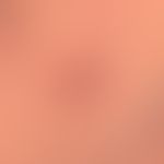 Dermal melanocytic nevus: known since earliest childhood. Only in recent years clear exophytic gr...