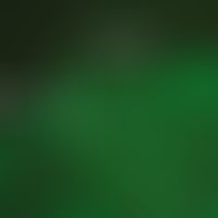 Lupus erythematodes chronicus discoides. direct immunofluorescence (DIF): band-shaped IgG deposit...