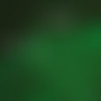 Systemic lupus erythematosus (overview): direct immunofluorescence (DIF) with detection of the lu...