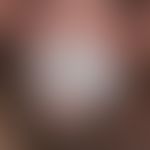 Lichen sclerosus of the penis: lichen sclerosus persisting for years with verrucous transformatio...