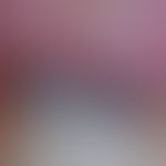 DD Hutchinson's sign: not quite fresh, bluish translucent subungual hematoma with hemorrhaging in...