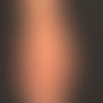 Kindler Syndrome: Atrophy ofthe skin with reticular pigmentation and circumscribed erythema
