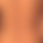 Kindler Syndrome: since birth, recurrent blistering after banal trauma; now poikilodermatous appe...