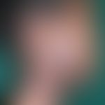 Zoster:&nbsp;Schwerer, nicht ganz frischer&nbsp;nekrotsierender Zoster mit tiefer Narbenbildung. ...