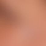 Vaskuläre Malformation (venöse vaskuläre Malformation):&nbsp;seit Jahren unveränderte, weiche, un...