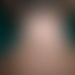 Vitiligo: Beginning spontaneous repigmentation
