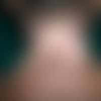 Vitiligo: Beginnende spontane Repigmentierung
