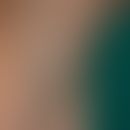 Trichobacteriosis axillaris: schwer abstreifbare, die Haare umhüllende Beläge von gelber Farbe. M...