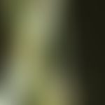 Bambus-Haar: charakteristische Haarschaftanomalie &nbsp;mit kugelgelenkartiger&nbsp;Invagination ...