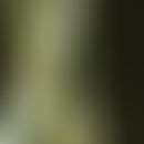 Bambus-Haar:&nbsp;charakteristische Haarschaftanomalie &nbsp;mit kugelgelenkartiger&nbsp;Invagina...