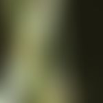 Bambus-Haar:&nbsp;charakteristische Haarschaftanomalie &nbsp;mit kugelgelenkartiger&nbsp;Invagina...