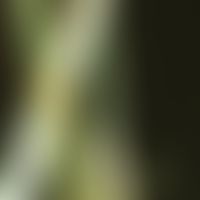 Bambus-Haar:&nbsp;charakteristische Haarschaftanomalie &nbsp;mit kugelgelenkartiger&nbsp;Invagina...