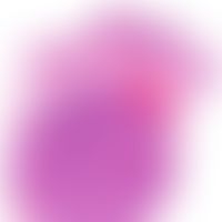Talgdrüsenadenom: gut abgegrenzbares lobäres Adenom in der oberen und mittleren Dermis mit erkenn...