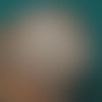 Tinea capitis (microspores): diffuse infestation of the entire capillitium. only moderate itching...