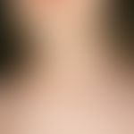 Malformation vaskuläre (subkutanes Lymphangioma cavernosum):&nbsp;erstmals im 1. LJ bemerkte, mit...