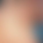 Neurofibromatose, segmentale.&nbsp;Segmental angeordnete hautfarbene, weiche, breitbasig aufsitze...