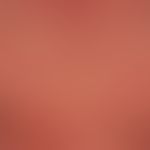 Pityriasis rubra pilaris (adulter Typ):&nbsp;seit Jahren chronisch-rezidivierender Verlauf mit Ph...