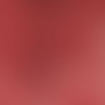 Plaques muqueuses (Randareal):&nbsp;disseminierte, kleinherdige, rote Plaques; erhaltene&nbsp;Pap...