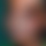 Leishmaniasis mucocutaneous (facies leishmaniotica): massive solid, persistent swelling of the up...