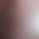 Mukokutane Leishmaniose:&nbsp;bei einem HIV-infizierten Patienten. Derbe, nicht schmerzhafte Schw...